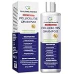 Análisis de los mejores productos antifúngicos para dermatitis seborreica en barbería